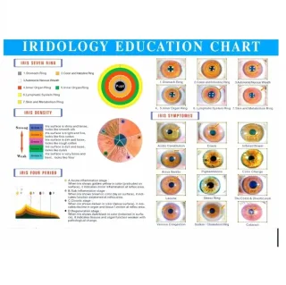 Câmera profissional de varredura de íris 12MP - Diagnóstico de saúde multifuncional, software de análise de íris, monitoramento de saúde ocular, imagem médica
